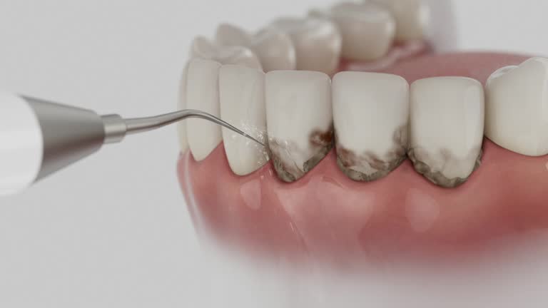 Reliable Dental contractor in Mountain Park, GA by Dentist Open Now
